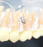 しろがね矯正歯科、姫路、矯正