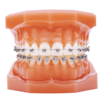 しろがね矯正歯科、姫路、矯正