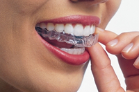 マウスピース型（カスタムメイド）矯正（歯科）装置